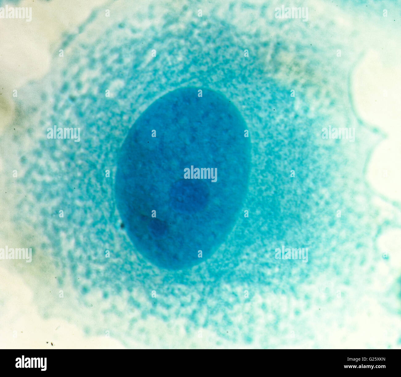 Umana PC-3 di cellule di cancro della prostata, colorati con blu Coomassie, sotto differencial interference contrast microscopio. Foto Stock