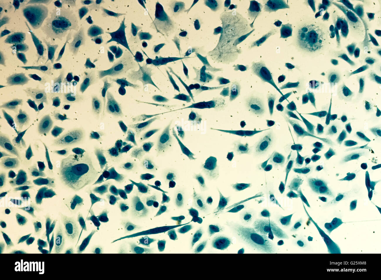 Umana PC-3 di cellule di cancro della prostata, colorati con blu Coomassie, sotto differencial interference contrast microscopio. Foto Stock