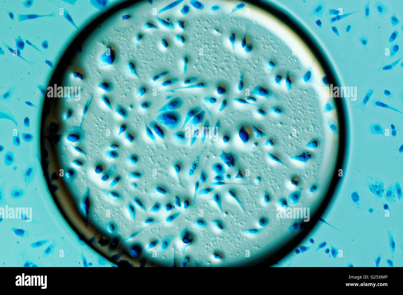 Umana PC-3 di cellule di cancro della prostata in bolla d'aria, colorati con blu Coomassie, sotto interferenza differencial microscopio a contrasto Foto Stock