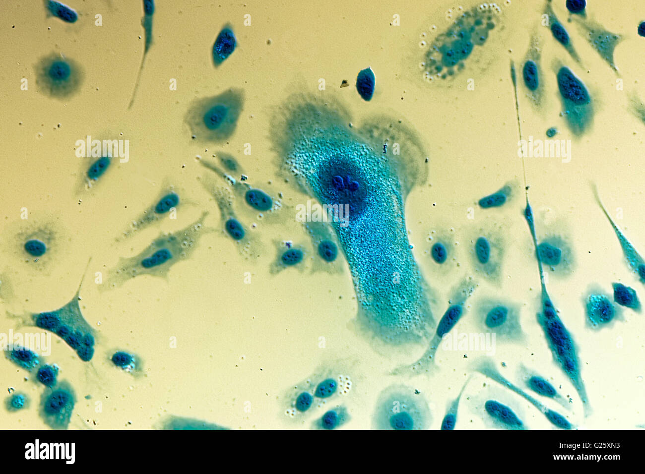 Umana PC-3 di cellule di cancro della prostata, colorati con blu Coomassie, sotto differencial interference contrast microscopio. Foto Stock