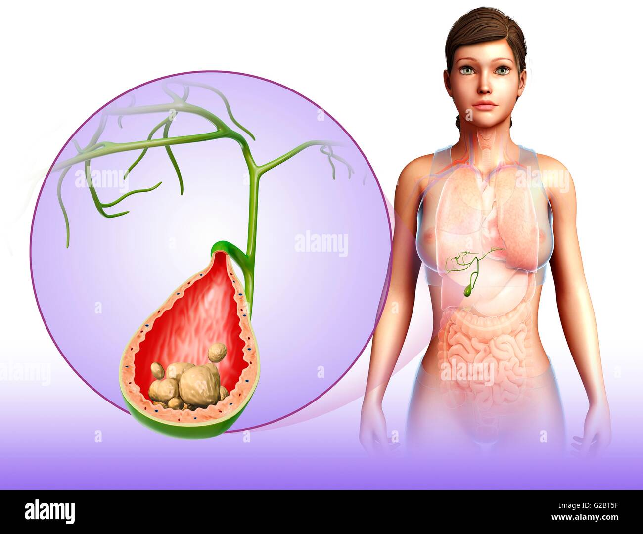 La cistifellea, illustrazione. Foto Stock