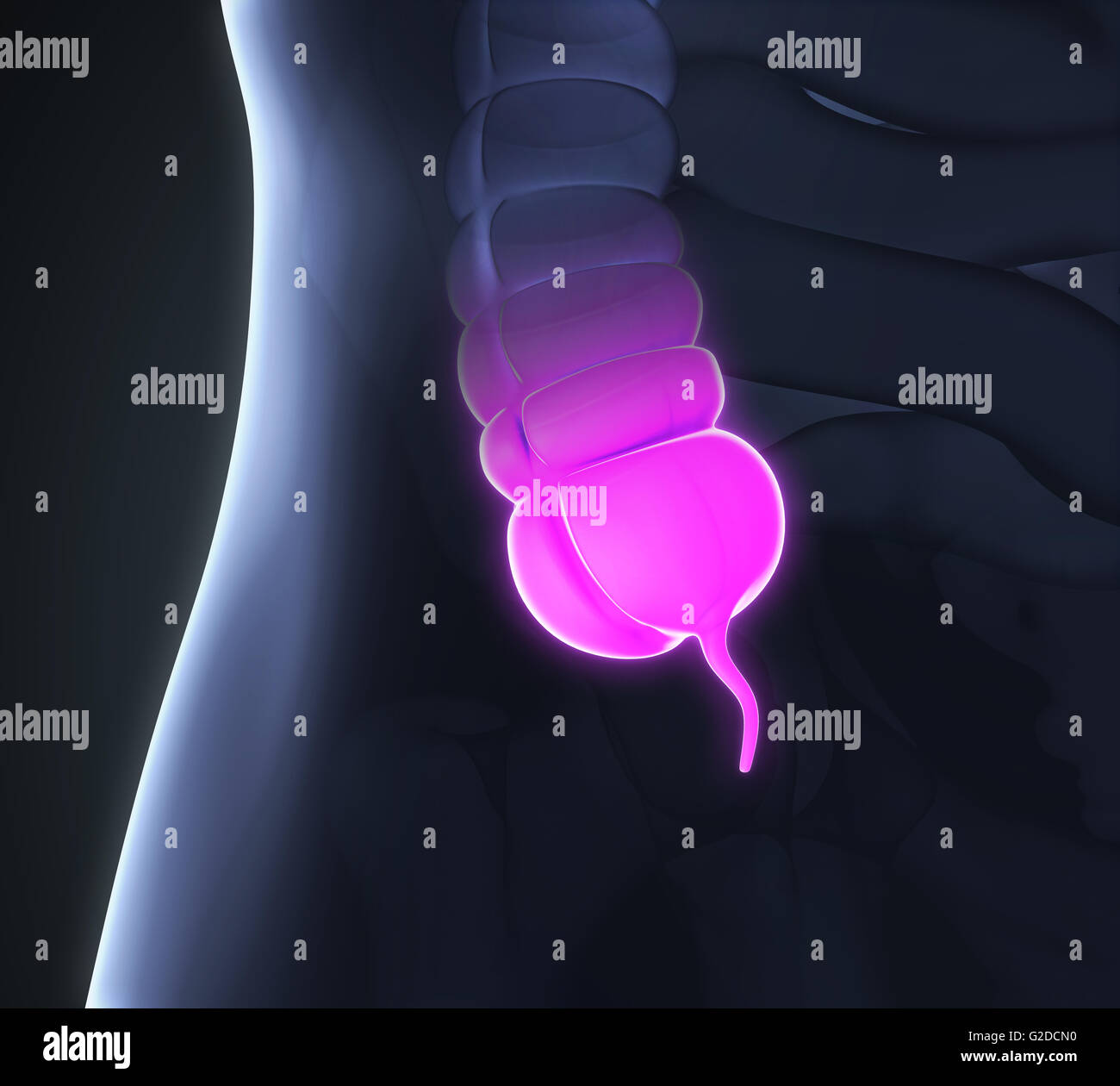 Appendice illustrazione del dolore Foto Stock