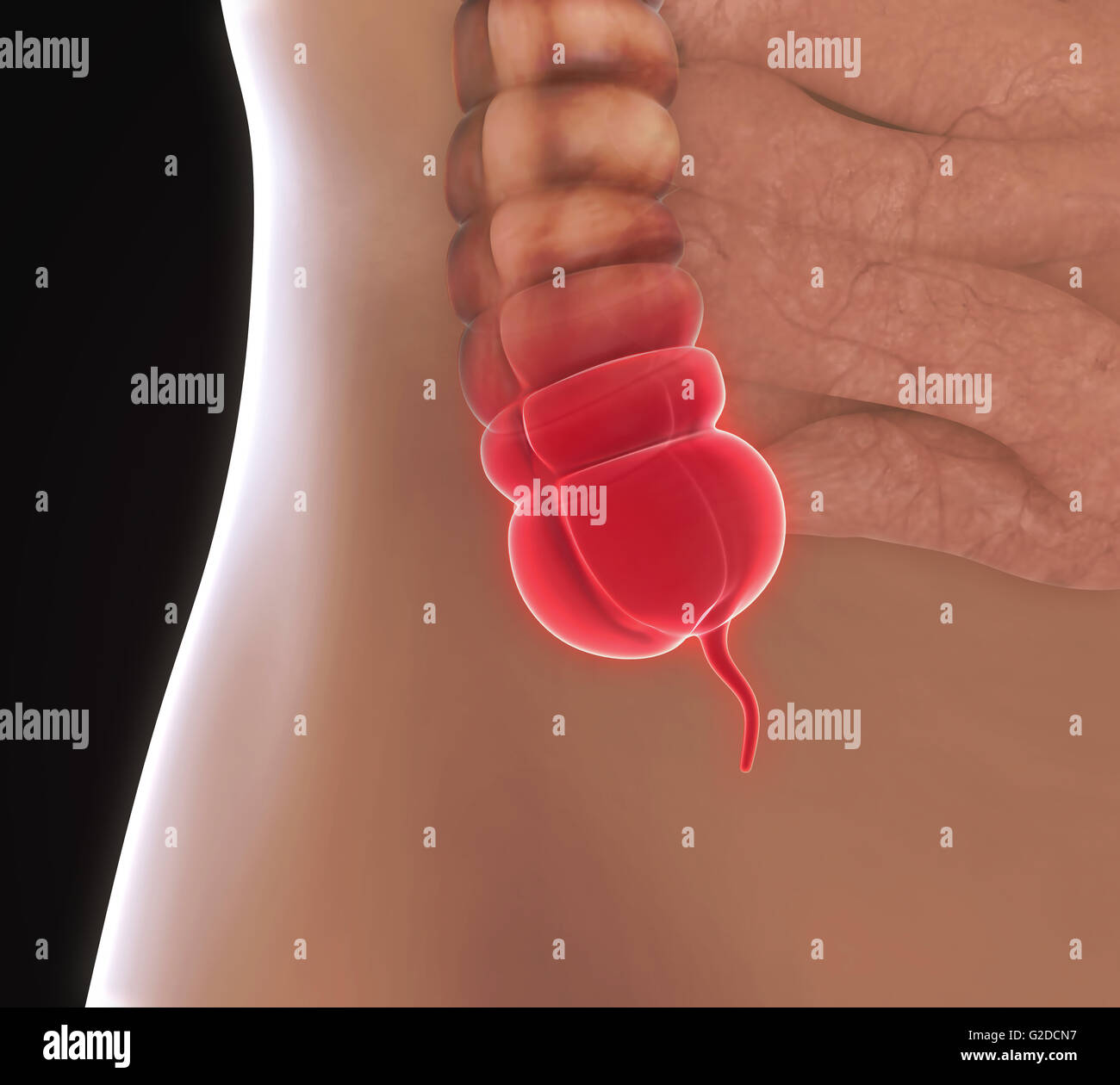 Appendice illustrazione del dolore Foto Stock