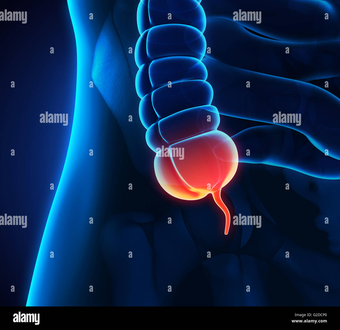 Appendice illustrazione del dolore Foto Stock