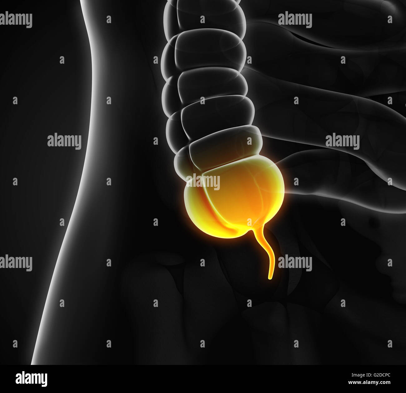 Appendice illustrazione del dolore Foto Stock