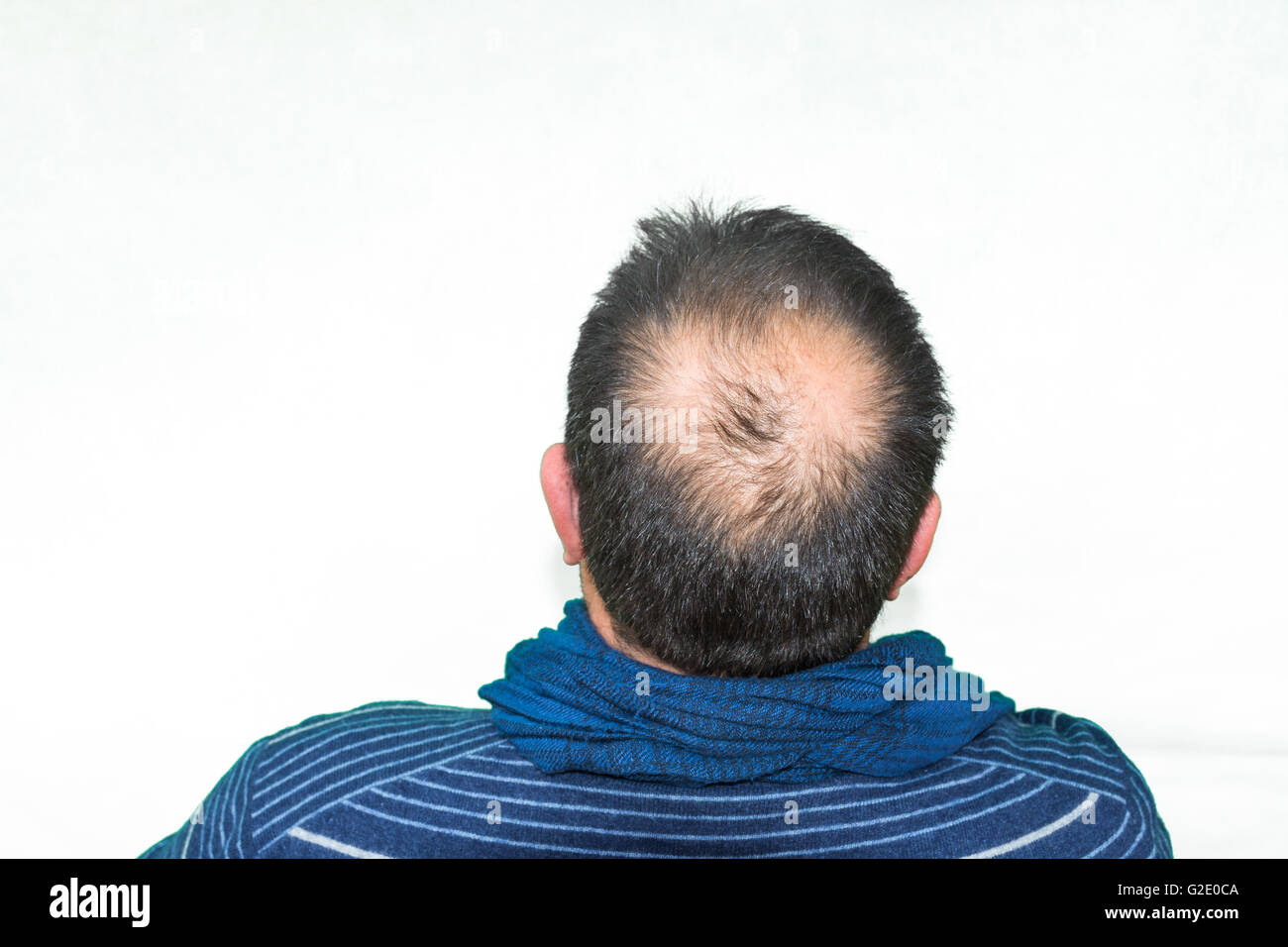 Maturo uomo yang, visto da dietro, nella testa, comincia a perdere i capelli, comincia ad essere vecchio. Foto Stock