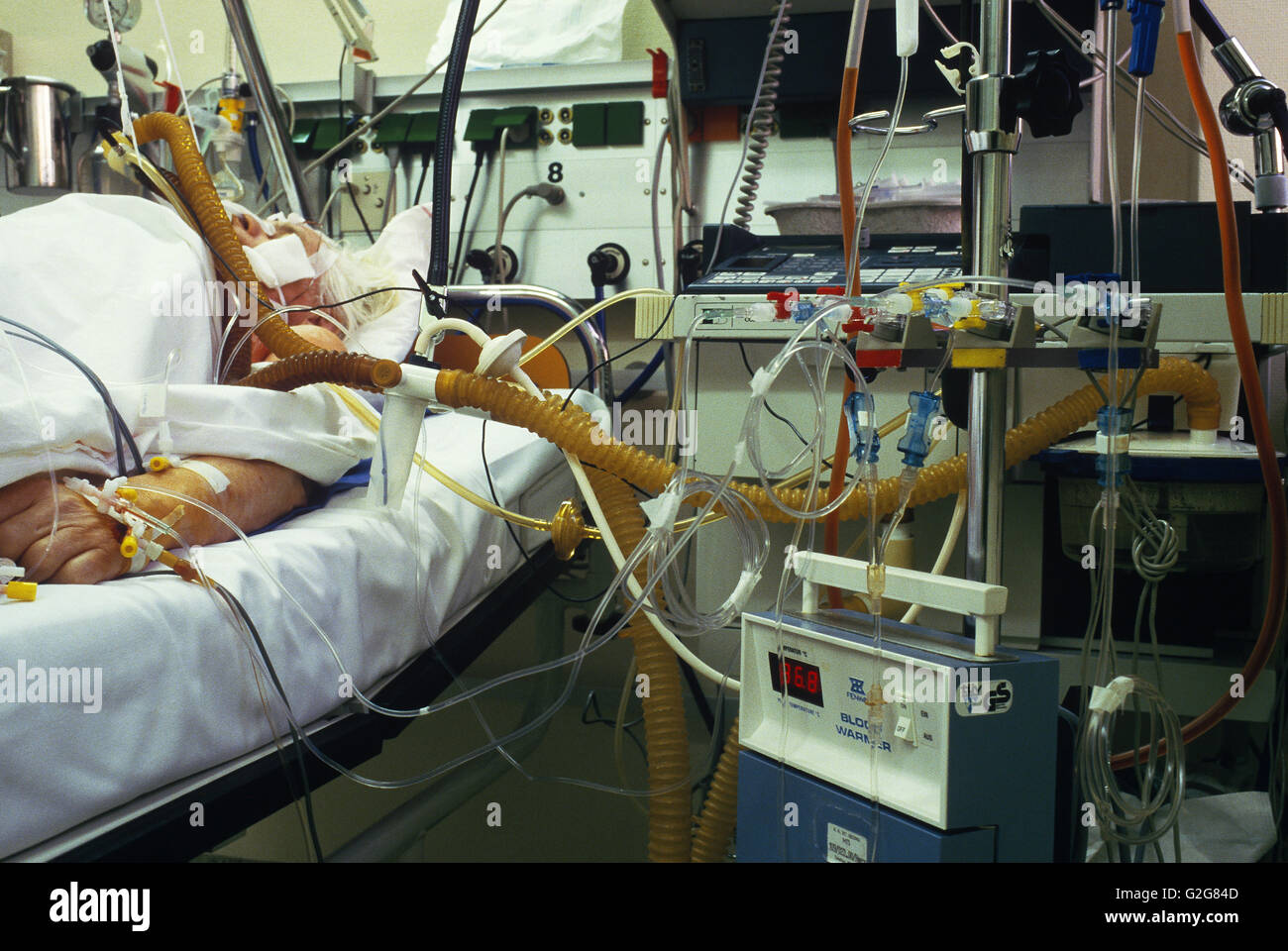 Il paziente in unità di terapia intensiva di St. Georg Hospital di Amburgo, Germania. Foto Stock