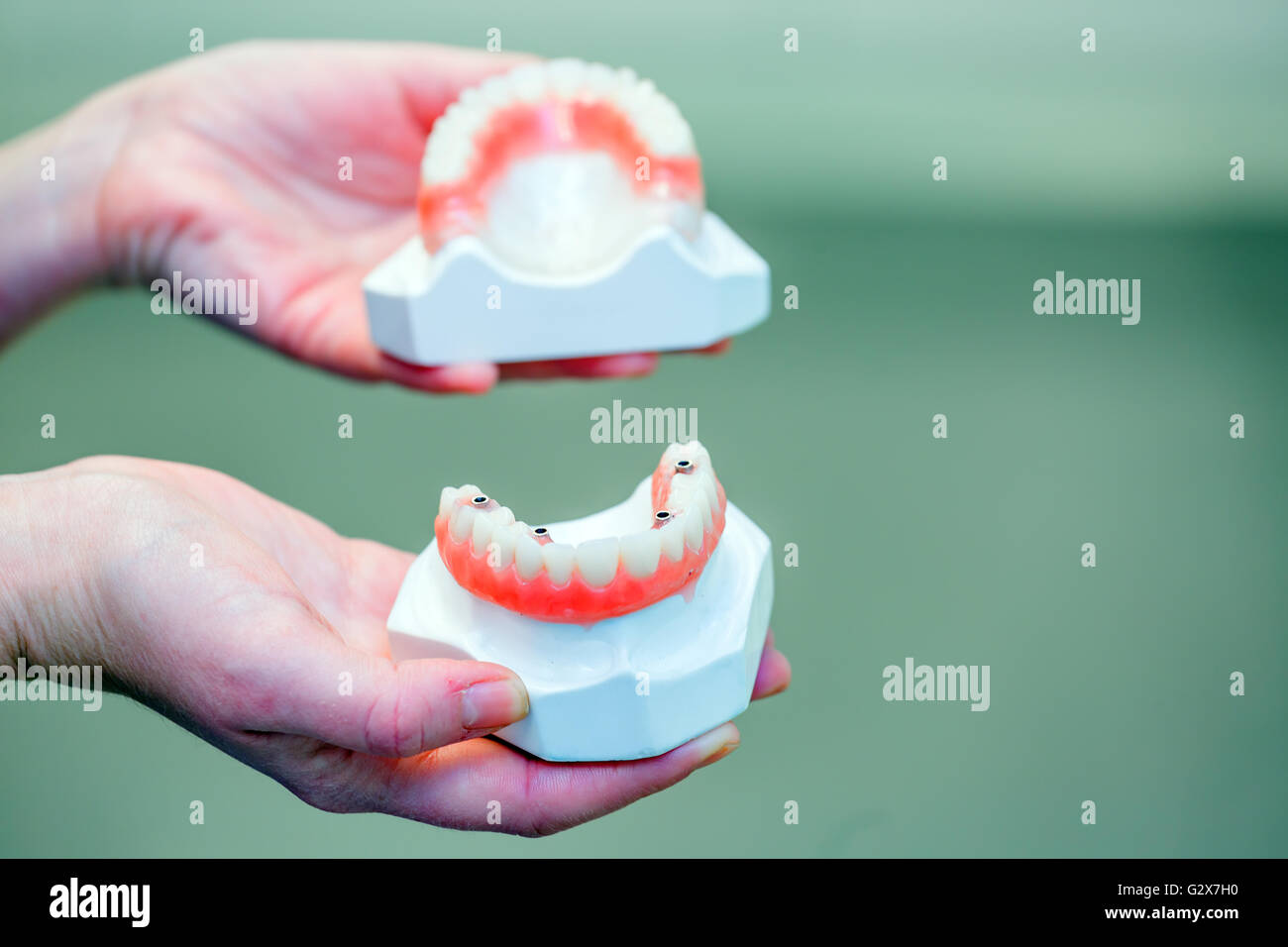 Mano che tiene una serie di protesi Foto Stock