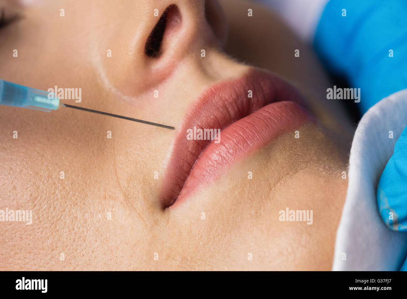 La donna riceve l'iniezione di Botox sulle labbra Foto Stock