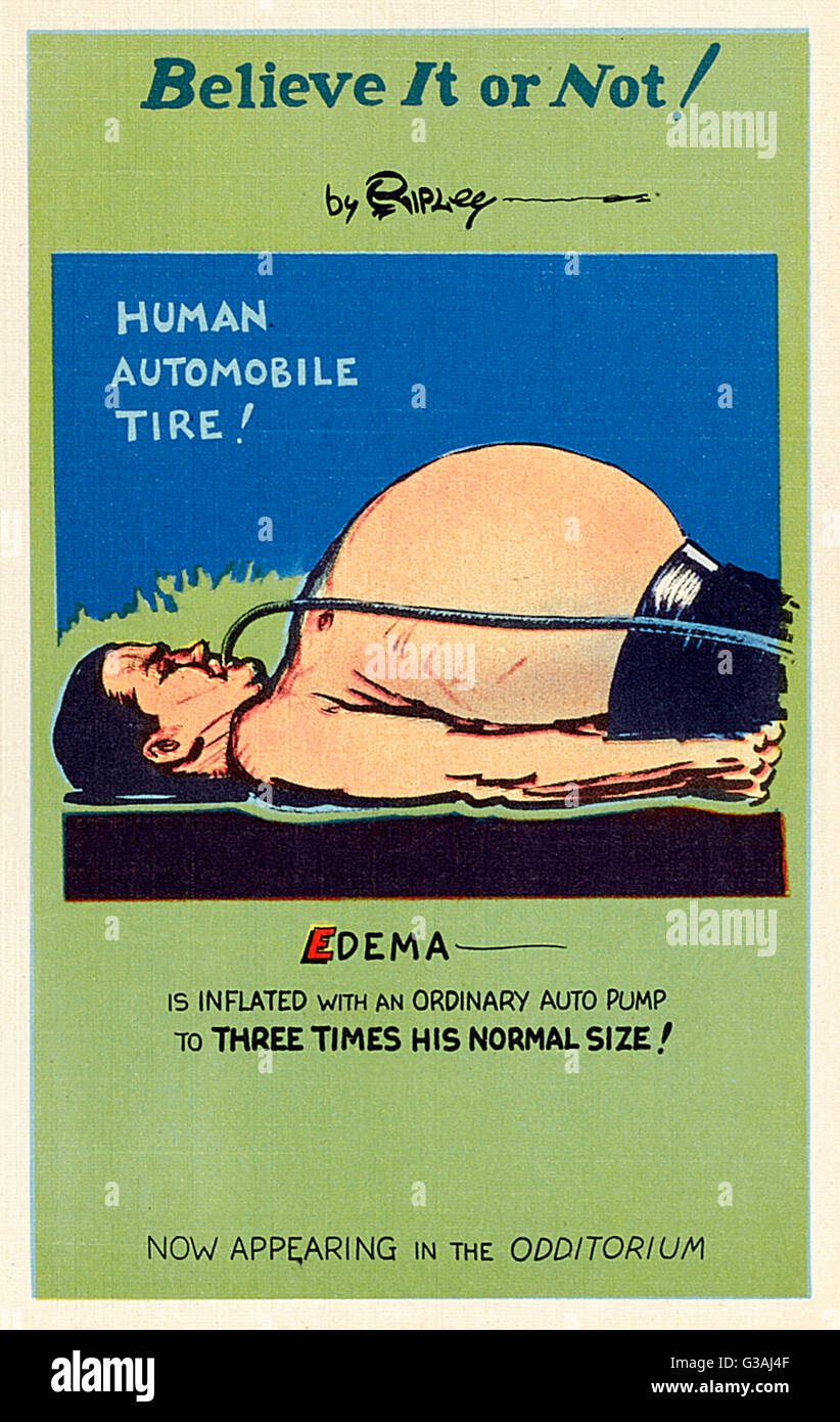 Ripley's "credere o non' - umani Automobile pneumatico - Wilber H. Roden ('edema') viene gonfiato con una normale pompa aria a tre volte la sua dimensione normale! Odditorium al alla fiera mondiale di New York del 1940. Data: 1940 Foto Stock