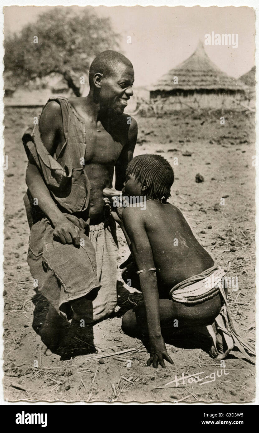 Ciad - Cupping - pratica medicinale indigena Foto Stock