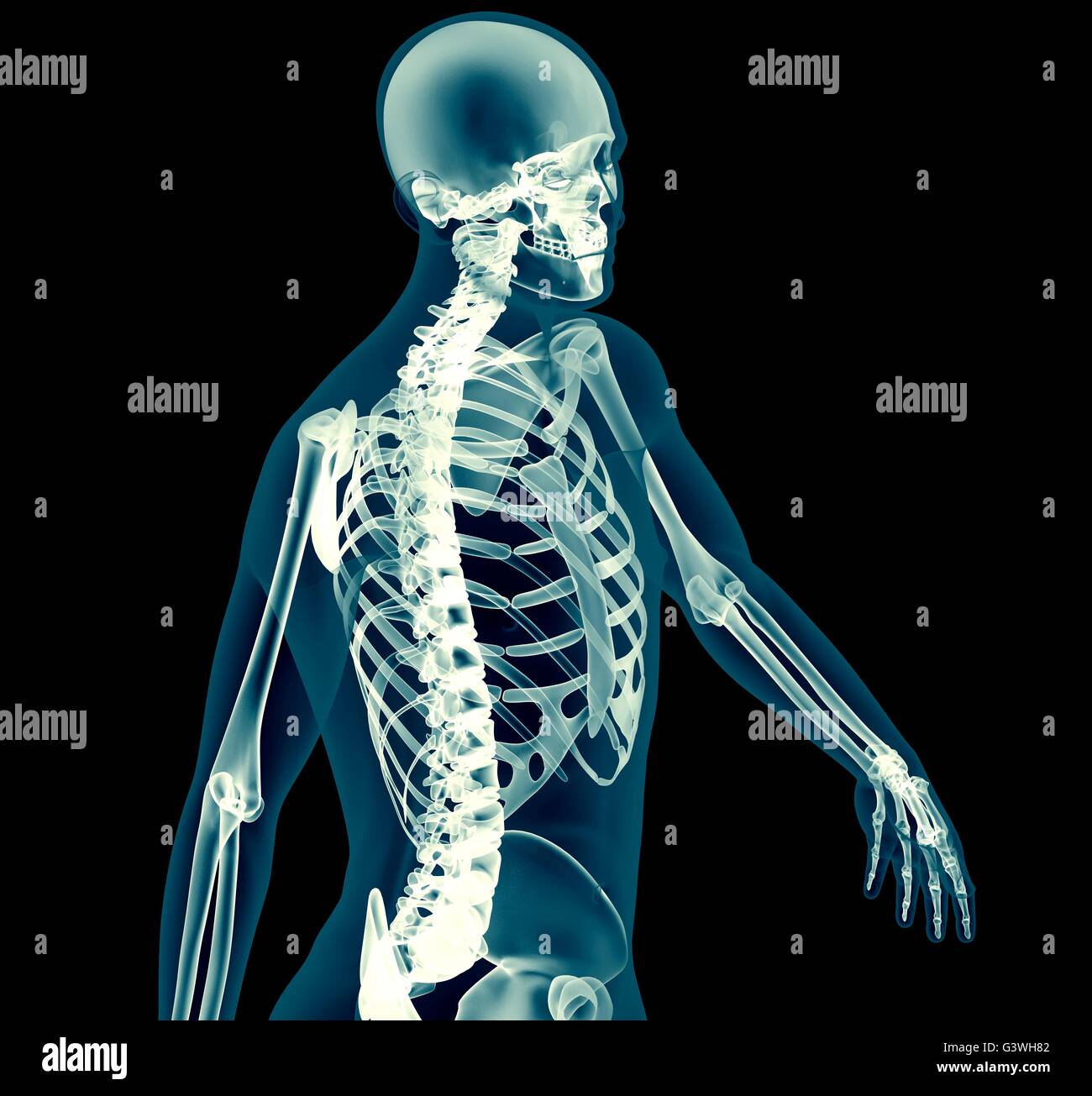 Immagine a raggi x di un uomo isolato su nero. Foto Stock