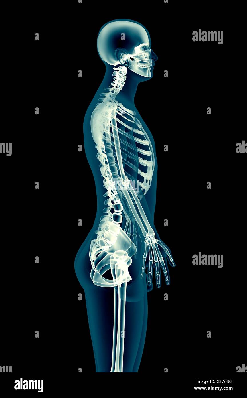Immagine a raggi x di un uomo isolato su nero. Foto Stock