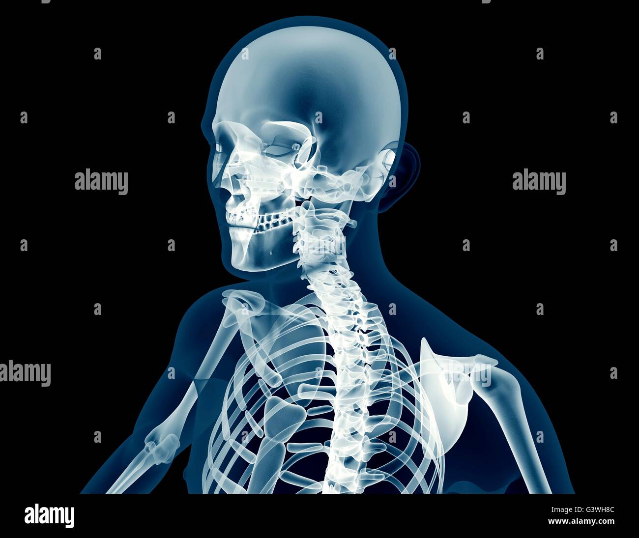 Immagine a raggi x di un uomo isolato su nero. Foto Stock