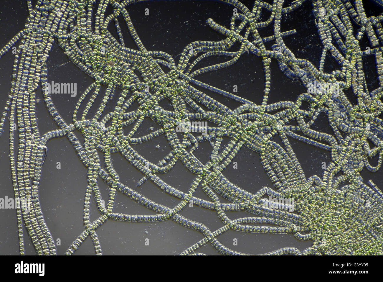 Ulothrix filamentose alghe verdi, campo oscuro fotomicrografia Foto Stock