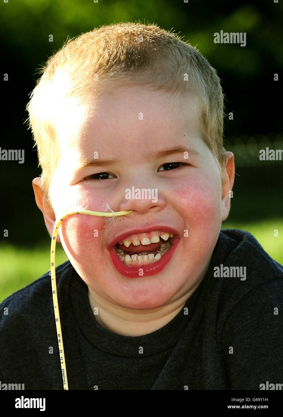 Mason Lewis a casa ad Atherstone, Warwickshire. Il ragazzo di quattro anni è diventato il più piccolo nel Regno Unito ad avere un trapianto polmonare riuscito. Foto Stock