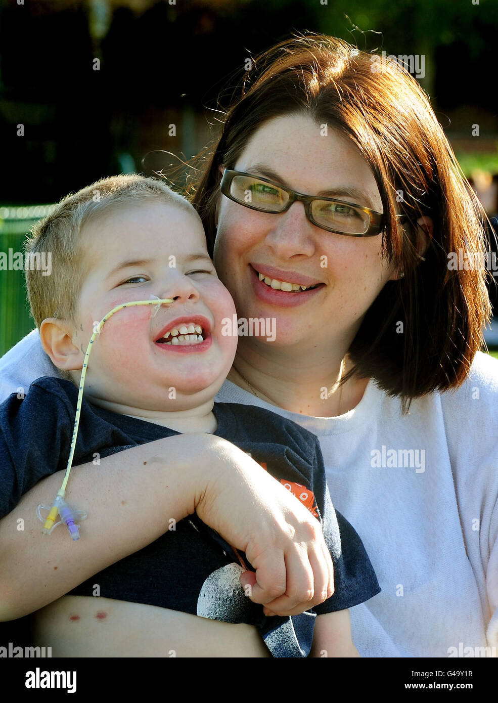 Più piccolo paziente ottiene nuovi polmoni Foto Stock