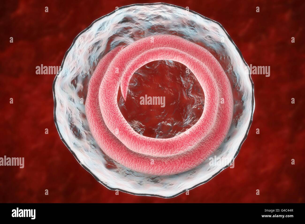 Cisti con Trichina spiralis nematode (in precedenza chiamato Trichinella spiralis), computer illustrazione. Questi parassiti possono infettare i mammiferi, compresi gli esseri umani, maiali, cani e ratti. Infezione segue il consumo di greggio o carne poco cotta che contiene le cisti della T. spiralis larve. Questi maturare nella forma degli adulti nell'intestino. Gli adulti vivono per circa 6-8 settimane, durante il quale tempo le femmine rilasciare un gran numero di larve che penetrano la parete dell'intestino. Da qui essi migrano intorno al corpo provocando febbre e dolori e la formazione di cisti nei muscoli. Foto Stock