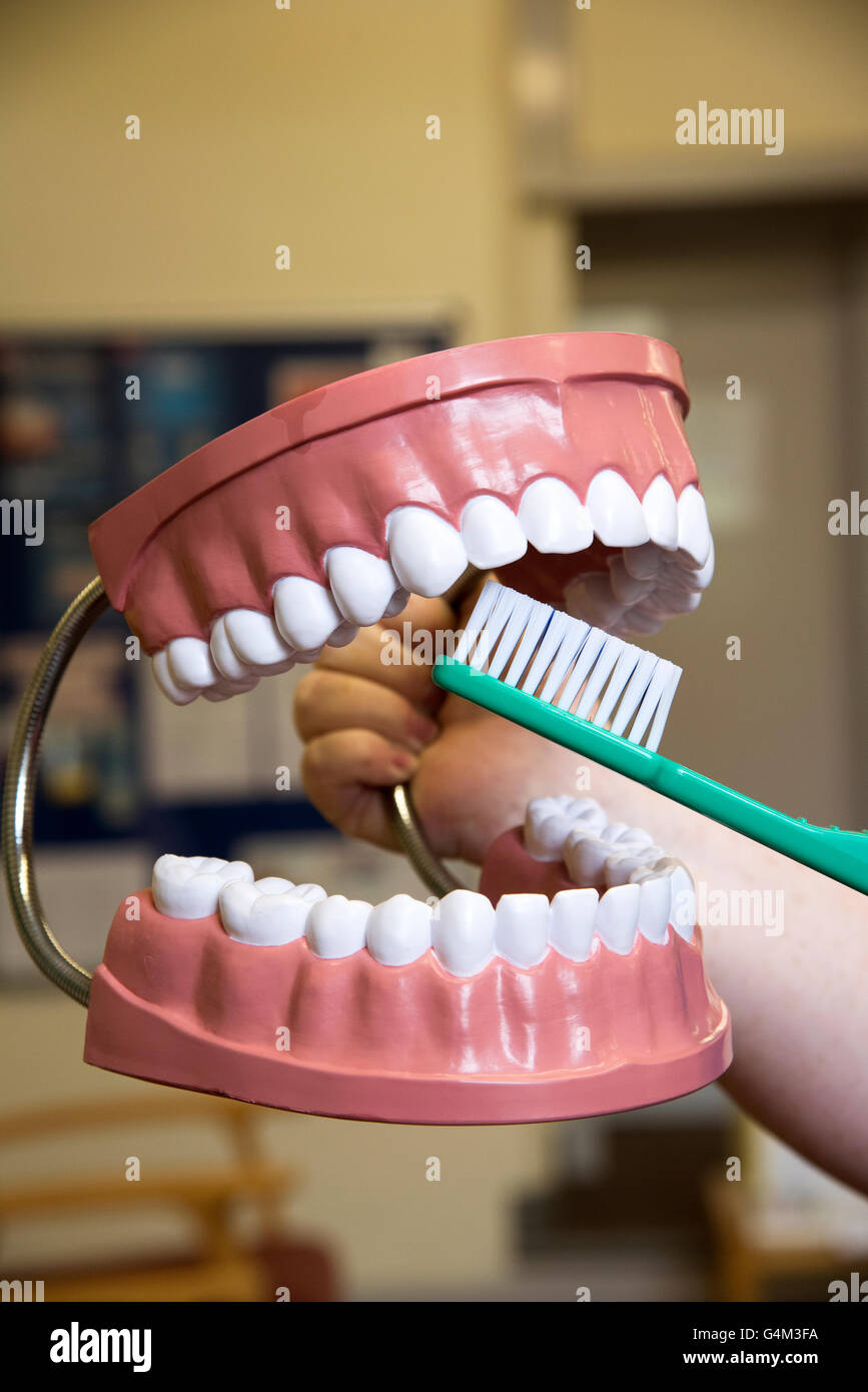 Dimostrazione di grande modello in plastica di denti e uno spazzolino da denti Foto Stock