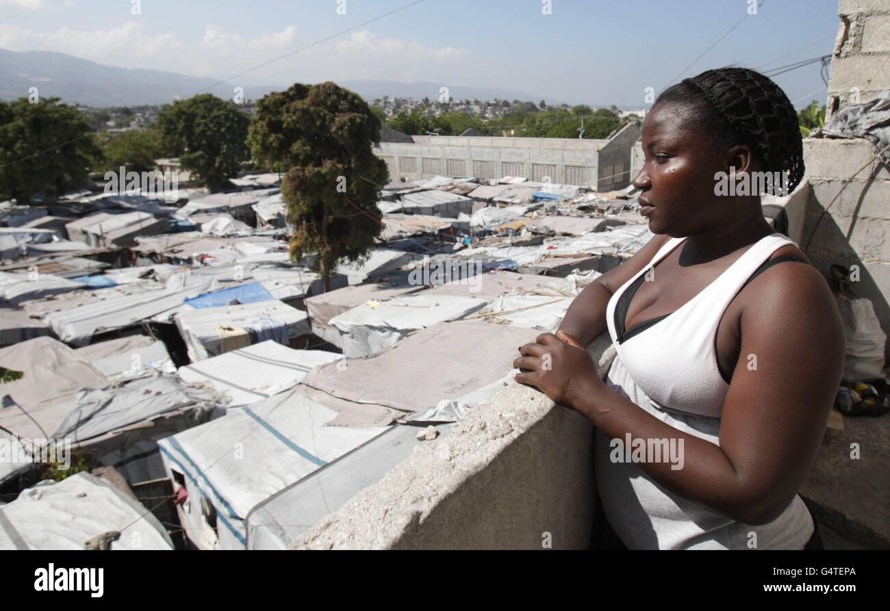 Nadia Almeda, che è stato ri-ospitato da ONG Irlandesi Concern, guarda al campo di Delmas 16 sfollati interni a Port-au-Prince, Haiti. Foto Stock