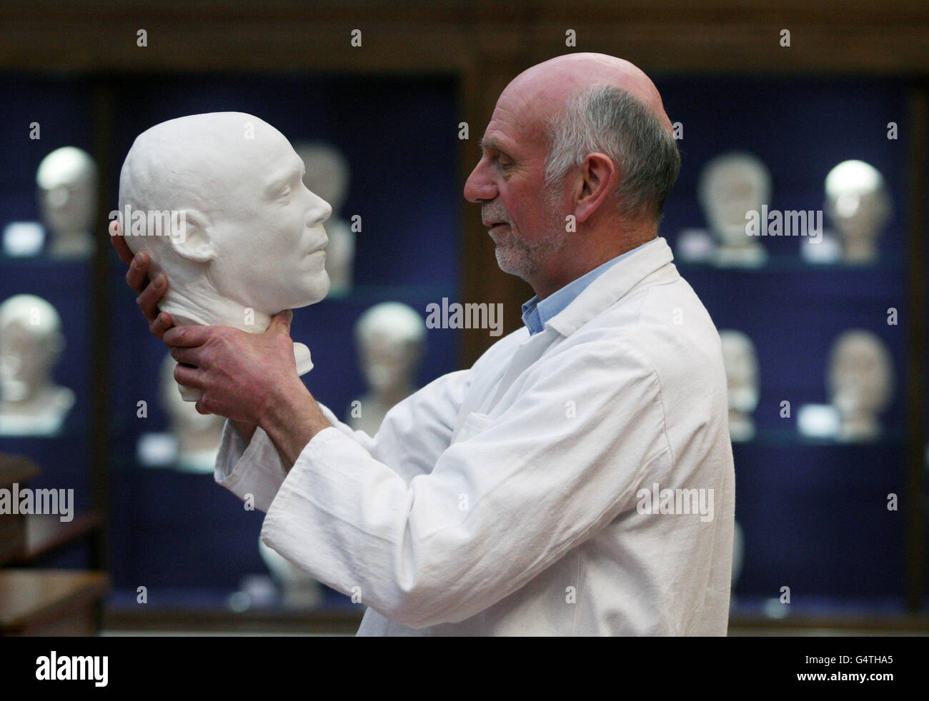 Il dottor Gordon Findlater conserva la maschera di morte dell'assassino di massa William Burke prima di essere esposto al pubblico in seguito a una revisione del Museo dell'anatomia all'Università di Edimburgo. Foto Stock