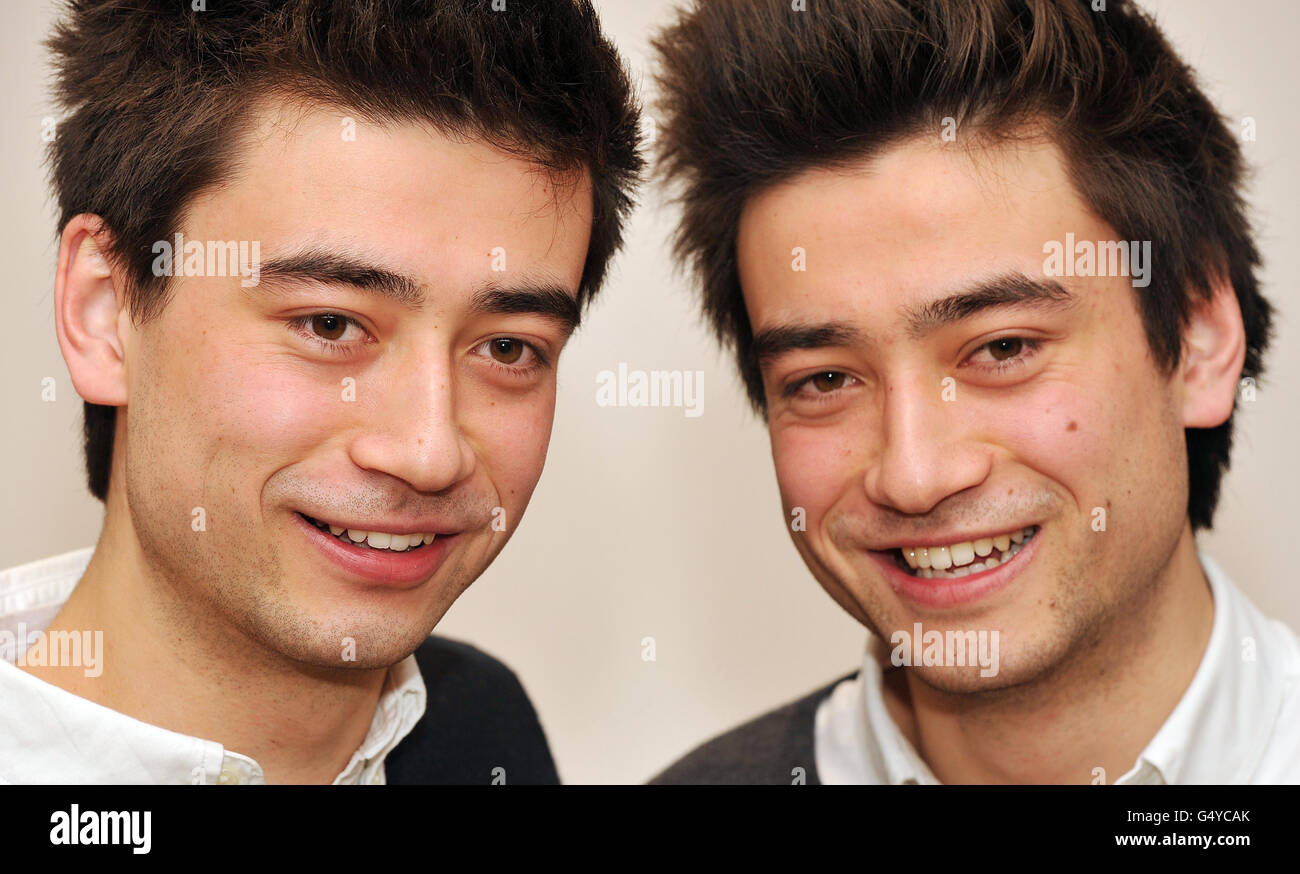 Gli studenti universitari Dan (a sinistra) e Michael Smith, gemelli di 20 anni, che hanno perso la vista in una questione di settimane a causa della neuropatia ottica di Leber, che è la perdita della vista dovuta alla morte delle cellule nel nervo ottico che trasmette le informazioni al cervello, una condizione rara per cui non vi è cura nota. Foto Stock