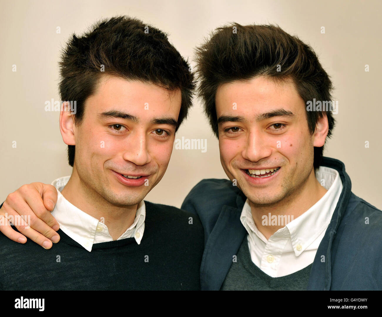 Gli studenti universitari Dan (a sinistra) e Michael Smith, gemelli di 20 anni, che hanno perso la vista in una questione di settimane a causa della neuropatia ottica di Leber, che è la perdita della vista dovuta alla morte delle cellule nel nervo ottico che trasmette le informazioni al cervello, una condizione rara per cui non vi è cura nota. Foto Stock