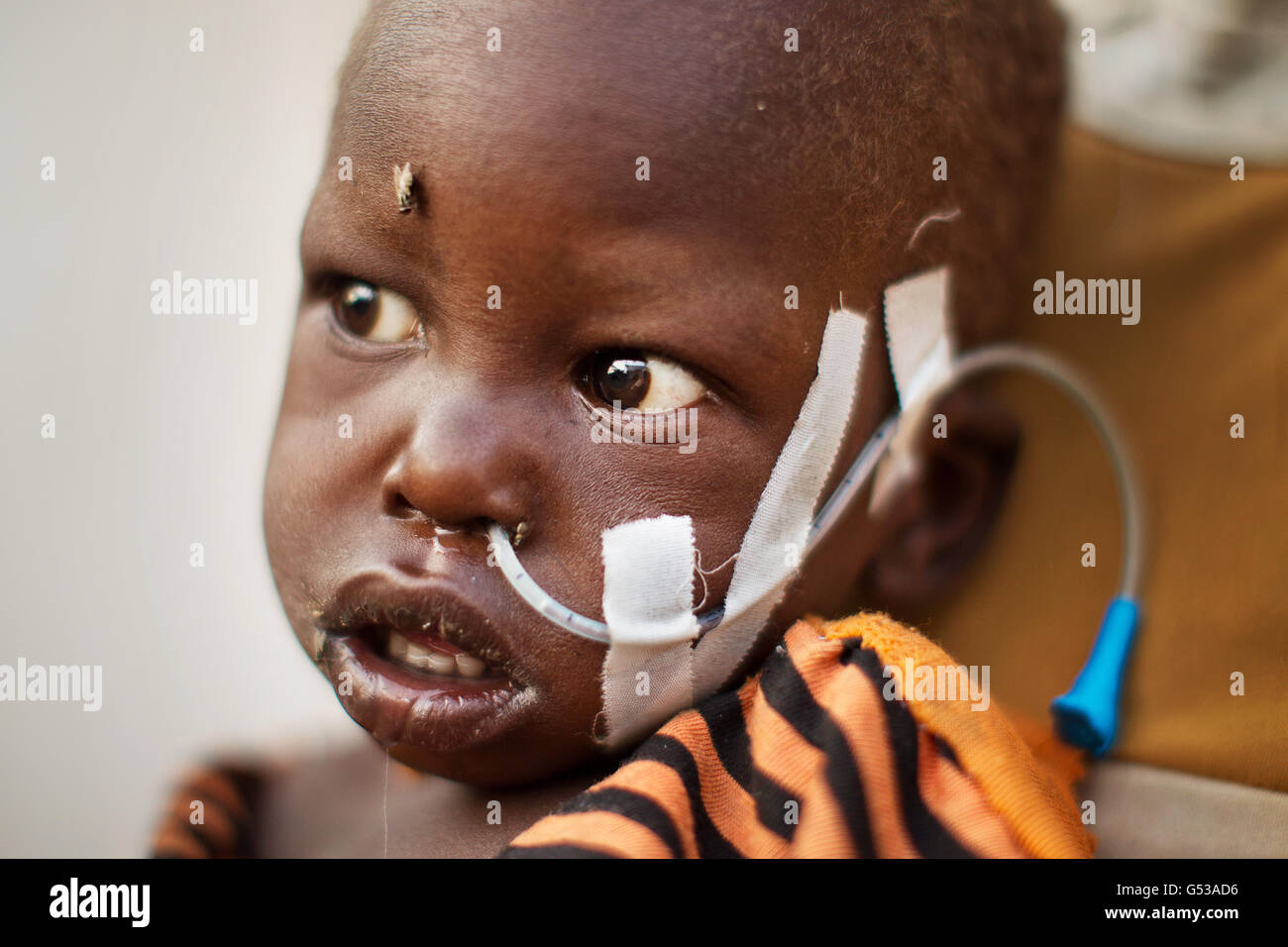 Un bambino ferito dal bombardamento del suo villaggio grida nella clinica nel campo profughi di Doro a Bunj, Maban, nello stato del Nilo blu superiore del sud-est del Sudan, Africa. La regione ha recentemente sofferto di gravi scontri tra il Nord e il Sud Sudan, con la conseguenza di decine di migliaia di persone costrette a rifugiarsi nei campi profughi come Doro e Jamman e centinaia di morti per i bombardamenti di villaggi e scontri tra gruppi armati rivali. Negli enormi campi profughi, la malattia e la malnutrizione uccidono I giovani, deboli e anziani e con le piogge minacciando a fine aprile il mayl sofferente worsen.Goal, gli irlandesi Foto Stock