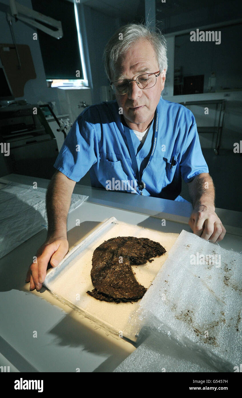 Il radiografo Mile Woodford presso il Salisbury District Hospital prepara a raggi X una borsa dell'età del bronzo, scavata da un sito di sepoltura di Dartmoor a Devon, che potrebbe rivelarsi uno dei più importanti reperti archeologici degli ultimi 100 anni. Foto Stock