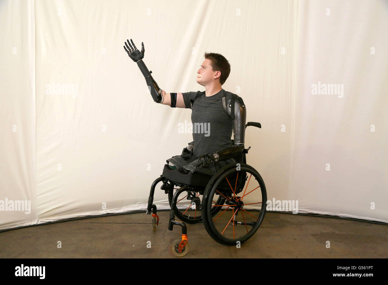 Alex Lewis, che ha perso le braccia e le gambe a causa della sindrome da shock tossico, indossa un braccio protesico sviluppato dall'Imperial College London's Mechatronics in Medicine Laboratory, Che è uno dei primi arti protesici al mondo che funziona attraverso le vibrazioni nei muscoli del braccio superiore, durante il lancio di quest'anno London Technology Week, il più grande festival europeo della tecnologia, a Shoreditch, Londra. Foto Stock Alex Lewis, che ha perso le braccia e le gambe a causa della sindrome da shock tossico, indossa un braccio protesico sviluppato dall'Imperial College London's Mechatronics in Medicine Laboratory, Che è uno dei primi arti protesici al mondo che funziona attraverso le vibrazioni nei muscoli del braccio superiore, durante il lancio di quest'anno London Technology Week, il più grande festival europeo della tecnologia, a Shoreditch, Londra. Foto Stock