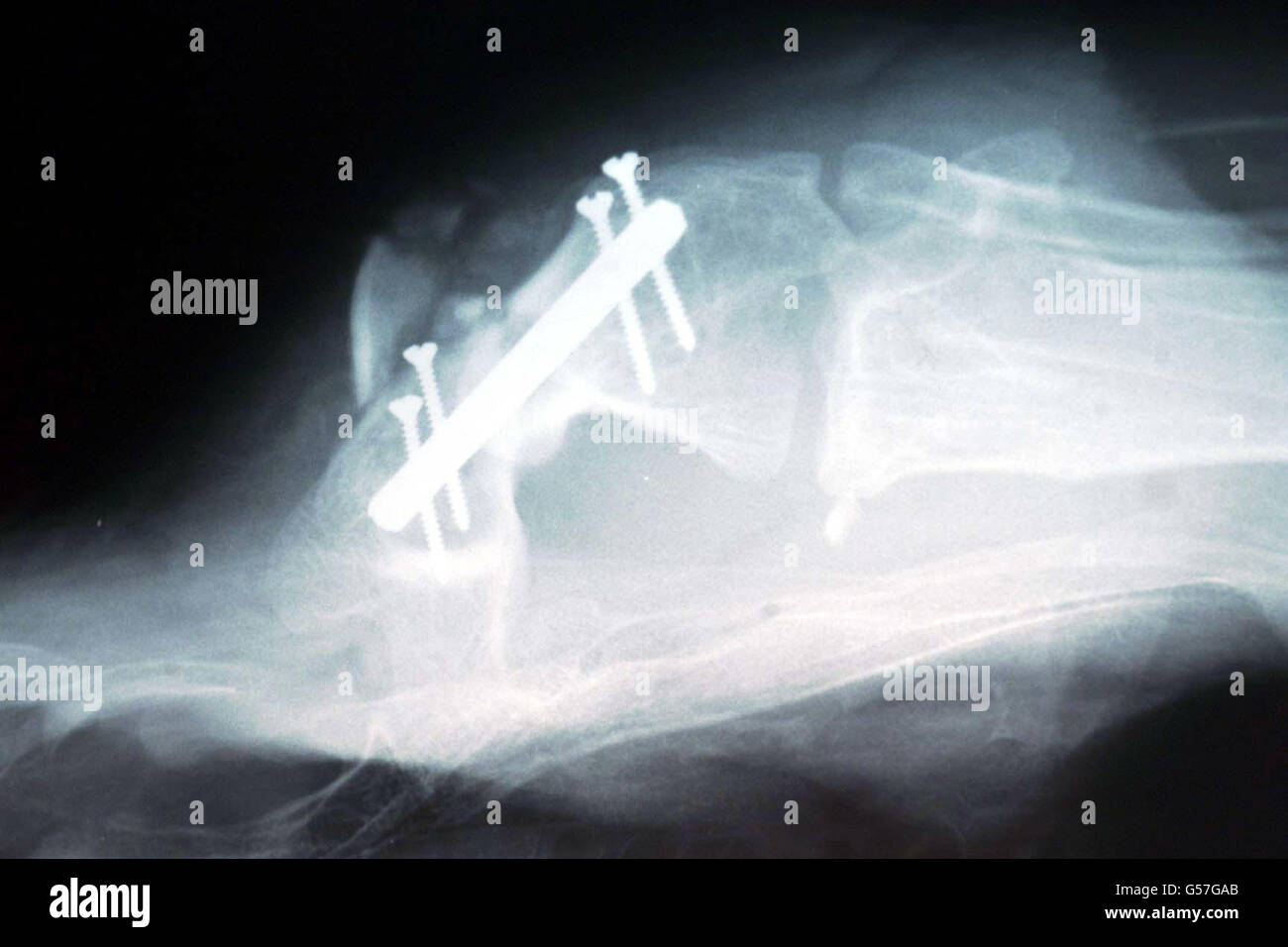 Cambridge Turchia gamba x-ray Foto Stock