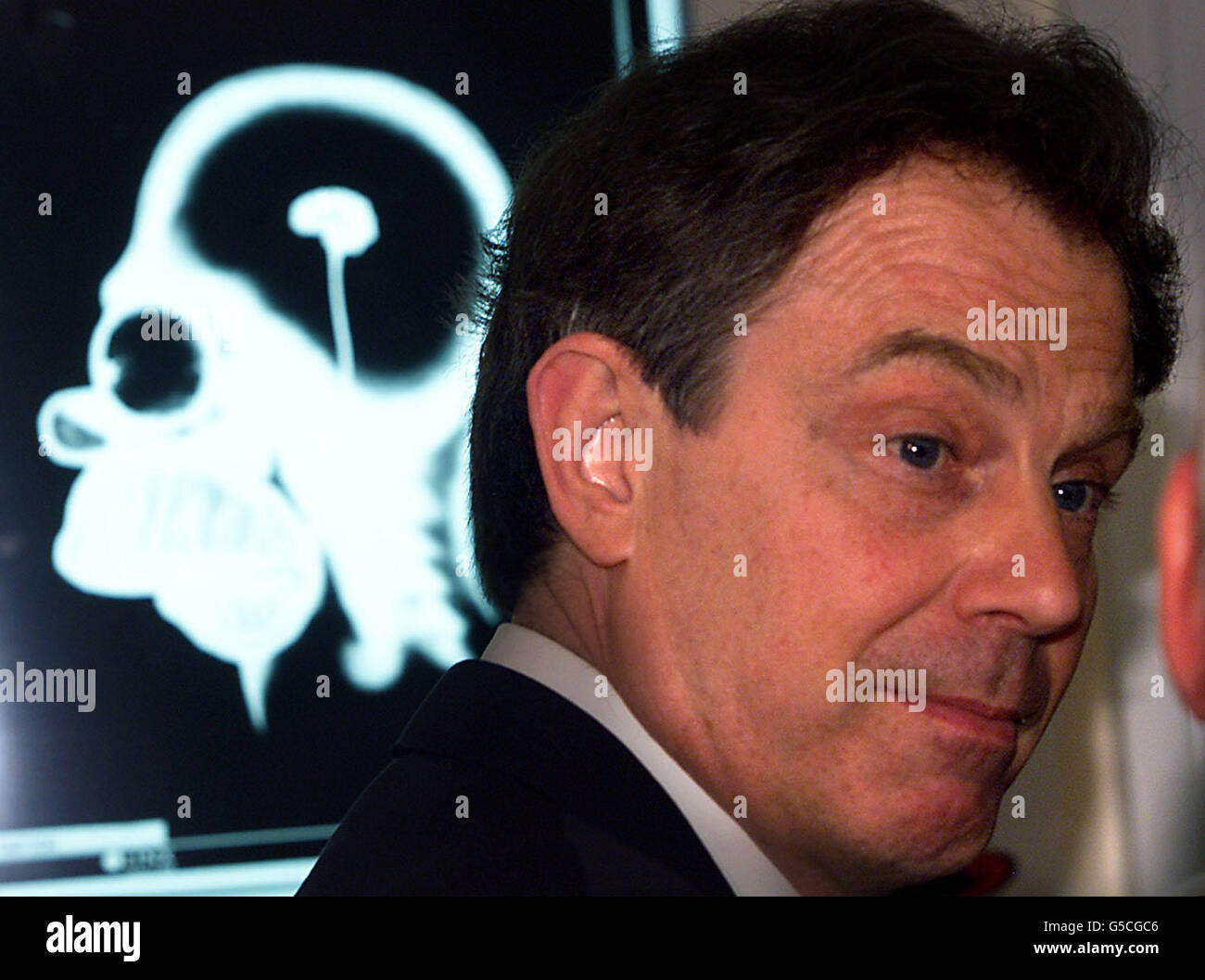 Il primo ministro britannico Tony Blair è visto di fronte a un 'X-Ray' del personaggio televisivo di cartone animato Omero Simpson, mentre visita l'ala MRI dell'ospedale Queen Elizabeth a King's Lynn, nel periodo fino alle elezioni generali del 7 giugno. Foto Stock