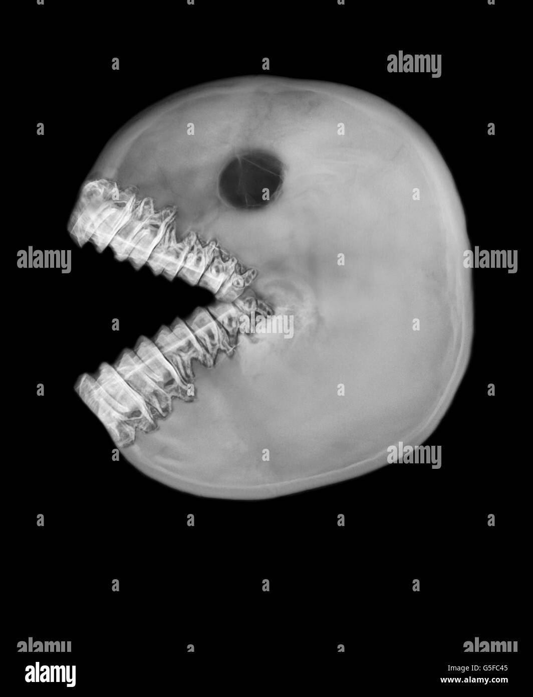 Teschio con struttura ossea visibile e denti naturali che formano una bocca aperta distintiva, somigliante al classico personaggio PAC Man, creando un effetto sorprendente Foto Stock