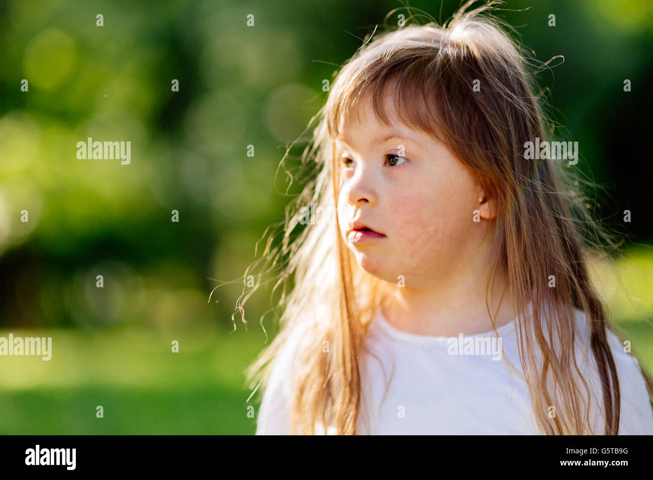 Ritratto di sindrome di down bambino nella natura Foto Stock