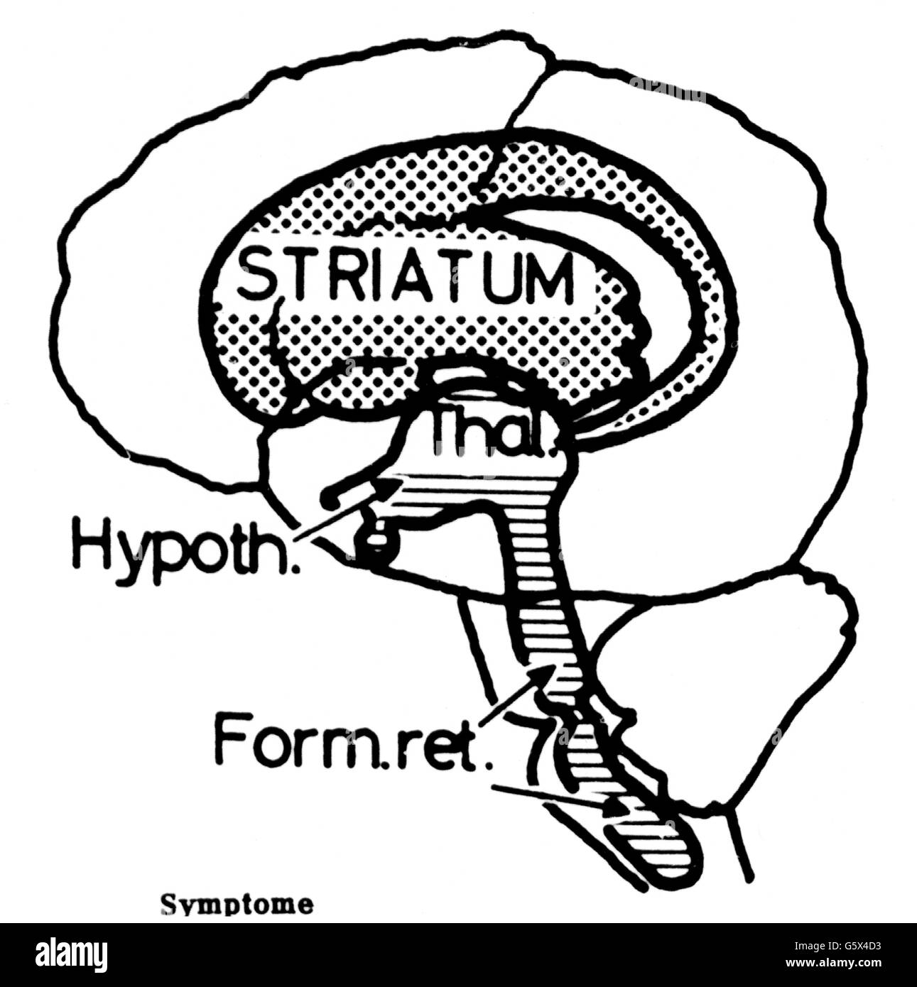 Medicina,farmacia,immagine schematica degli effetti dei farmaci contro i problemi psicosomatici che possono causare sintomi simili al morbo di Parkinson,disegno,XX secolo,XX secolo,grafica,schema,schema,schemi,cervello,cervello,farmaco,farmaco,farmaci,pillola,compresse,compresse,stato di ansia,stato di ansia,stato di stress,stati di stress,effetti collaterali psicotici,effetti collaterali aggiuntivi,effetti collaterali-cancellativi,effetti collaterali-non-disponibili,effetti collaterali-farmacologici,effetti collaterali-farmacologici,effetti collaterali,effetti collaterali-disponibili,effetti collaterali-farmacologici,effetti collaterali-farmacologici,effetti collaterali,effetti collaterali-non-disponibili Foto Stock