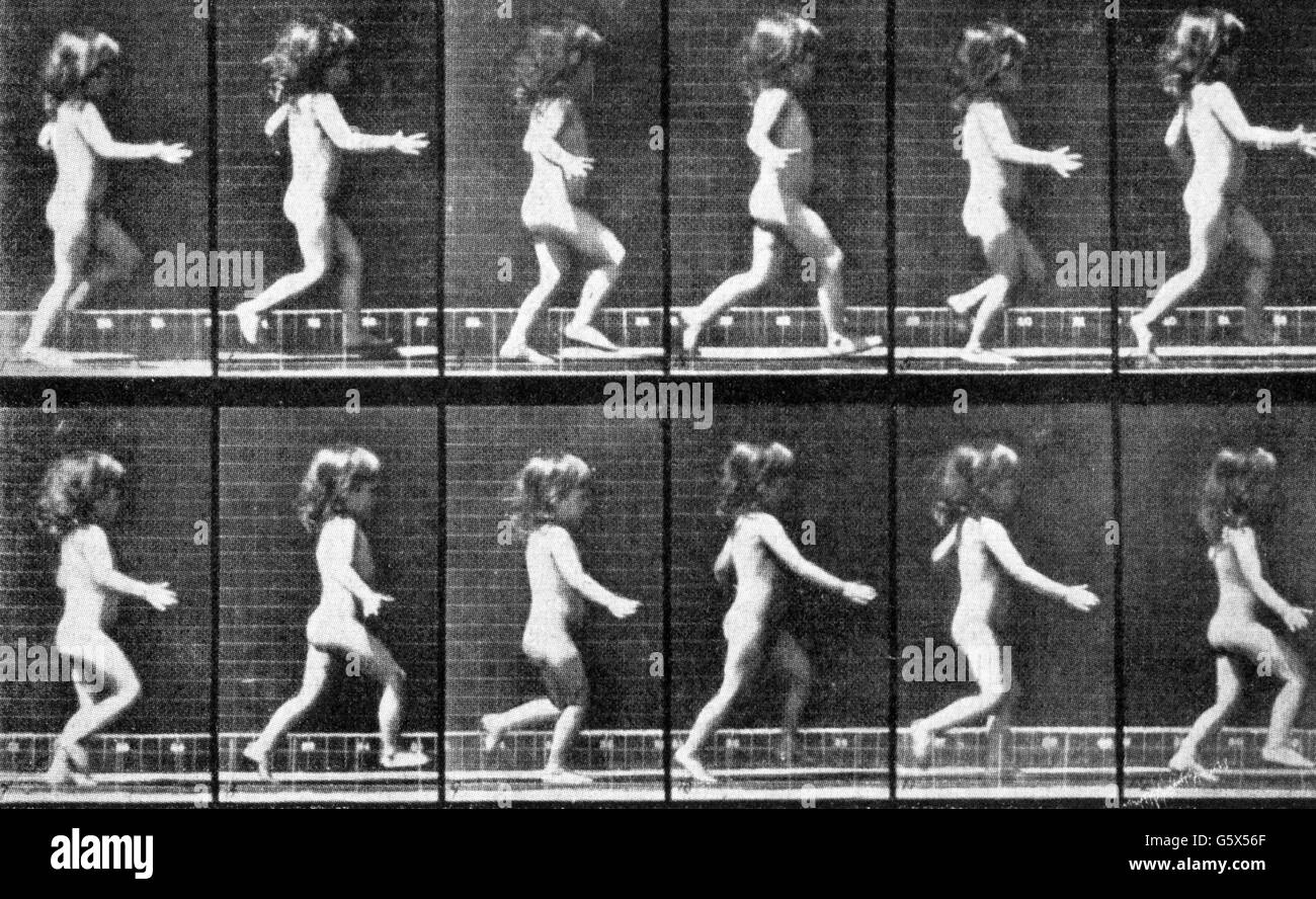 Muybridge, Eardweard, 9.4.1830 - 8.5.1904, fotografo britannico, opere, serie di foto per scopi medici, circa, 1882, Foto Stock