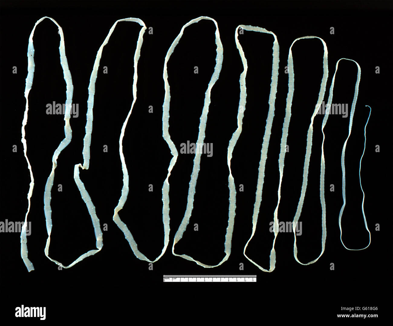 La tenia echinococco. Adulto Taenia saginata verme a nastro, di circa 4 metri di lunghezza (scala a piedi della foto). Foto Stock