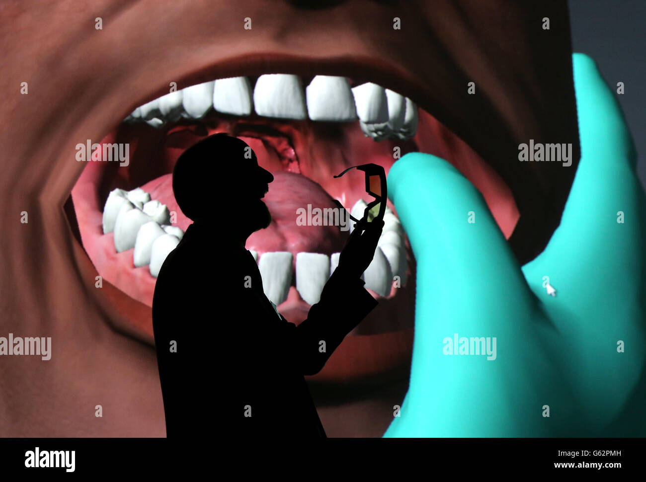 Presentato il modello di formazione medica 3D. 1.5 milioni di investimenti nella formazione medica. Foto Stock