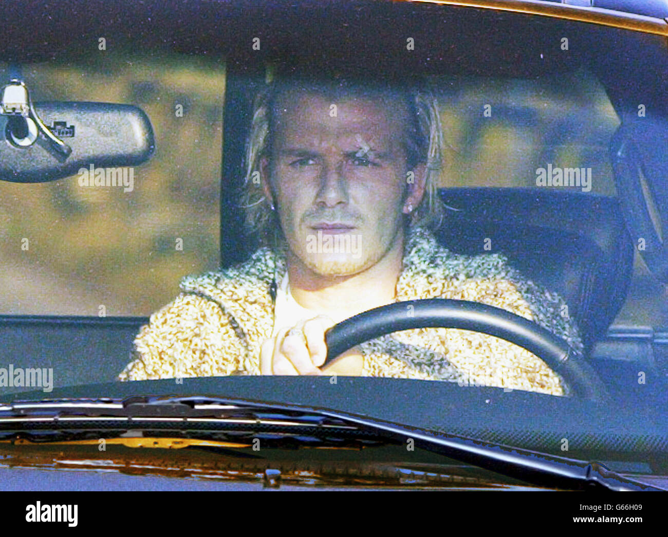 David Beckham, la star del calcio del Manchester United, arriva al centro di allenamento di Carrington con un gesso sull'occhio sinistro. * il manager Sir Alex Ferguson ha giocato il suo arrabbiato scontro con Beckham, affermando che il sopracciglio tagliato della stella del calcio è stato causato da "un atto di natura disonesto". Il capitano dell'Inghilterra ha sofferto un gash sopra il suo occhio sinistro quando un sir furioso Alex ha calciato una scarpa da calcio attraverso lo spogliatoio dopo che United è uscito dalla fa Cup a casa di Arsenal il sabato. Foto Stock