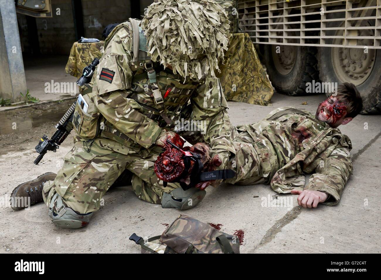 NOTA DELLA REDAZIONE: CONTENUTO GRAFICO UNA medaglia da 1 Regiment medico Corporal Kabir Rai prende parte ad una esposizione realistica di addestramento medico, al Copehill Down Village, sull'attore di trauma incidente George McNamara, Chi è un amputato sotto il ginocchio, mentre la ventesima Brigata blindata si prepara per il dispiegamento in Afghanistan sull'ultima operazione delle forze britanniche HERRICK (Op HERRICK 20). Foto Stock