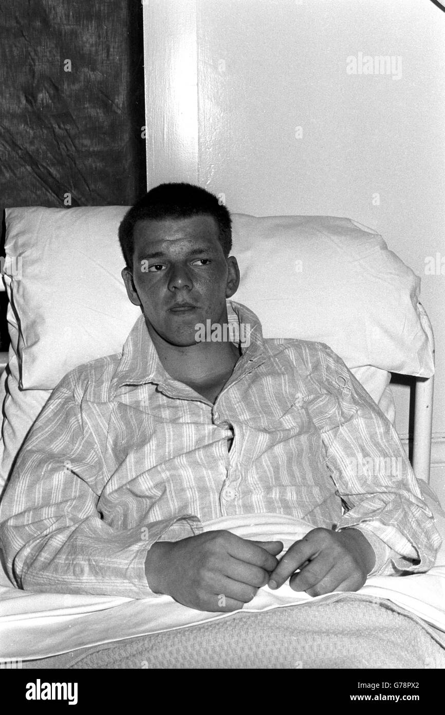 Privato Jimmy Cooper, 20, di Kirkaldy, Fife, Scozia, All'ospedale militare di Cambridge ad Aldershot dopo che è stato ferito nei bombardamenti del pub a Guildford. Foto Stock