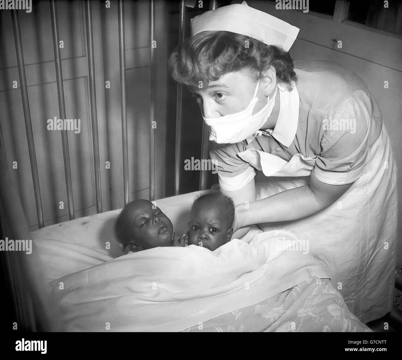 Medical - gemelli siamesi - Hammersmith Hospital di Londra Foto Stock