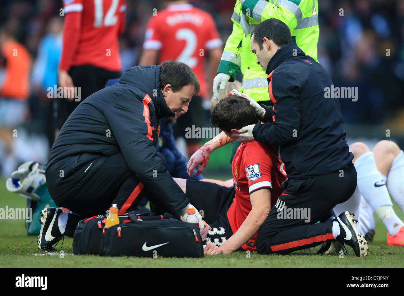 Patrick McNair del Manchester United riceve il trattamento per un taglio dopo uno scontro di teste durante la fa Cup, partita Third Round a Huish Park, Yeovil. Foto Stock