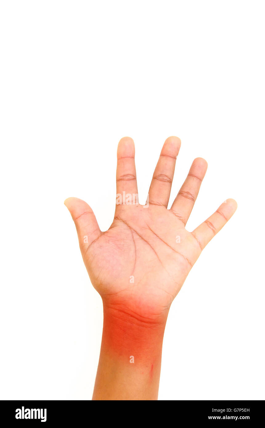 Bambini mano con dolore su sfondo bianco Foto Stock