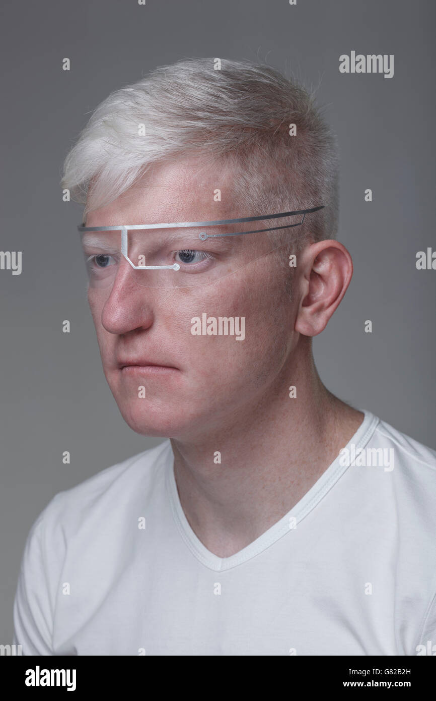 Close-up di albino uomo che indossa occhiali protettivi contro lo sfondo grigio Foto Stock