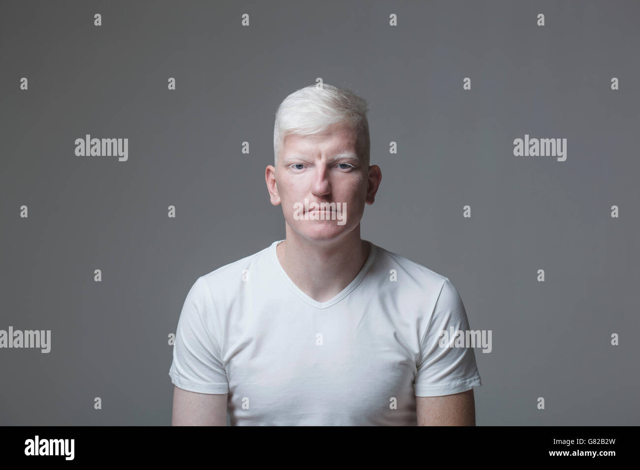 Ritratto di giovane uomo albino contro uno sfondo grigio Foto Stock