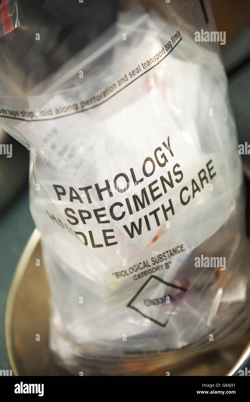 Campioni di patologia in attesa di raccolta dal NHS chirurgia GP Foto Stock