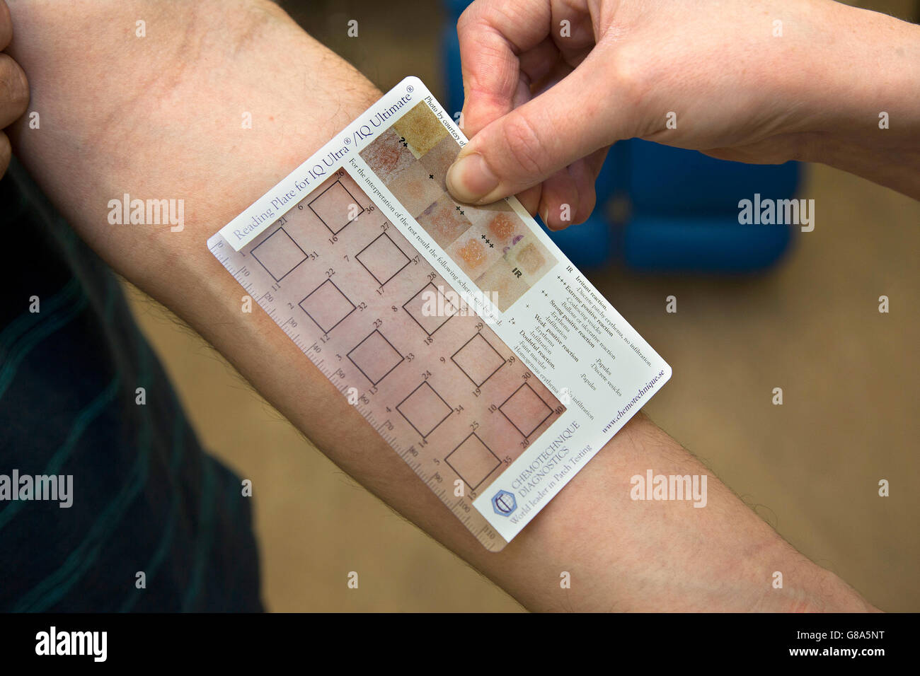 Il dermatologo con un IQ Ultra patch per il test per le allergie Foto Stock