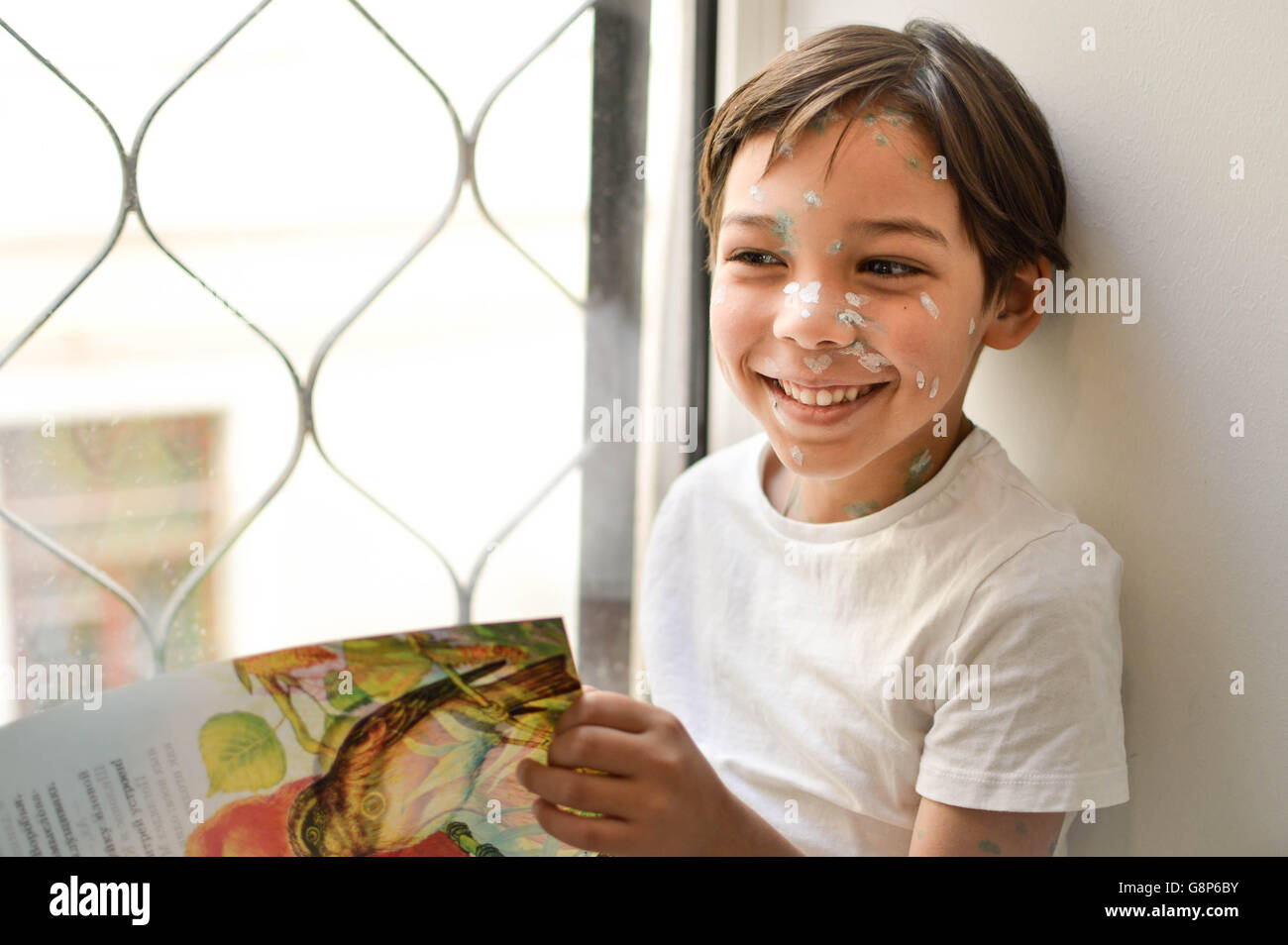 Bambino a casa malato con la varicella, bianco e verde crema antisettica applicata al rash Foto Stock