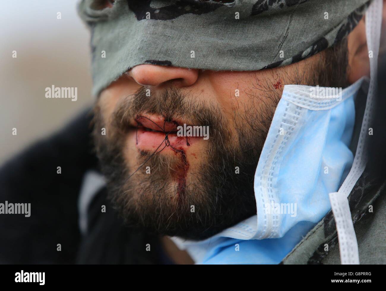 I migranti protestano mentre continuano le demolizioni nel campo migrante di Calais, noto come la giungla, nella Francia settentrionale. Foto Stock